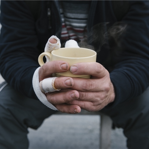 Nahaufnahme von bandagierten Händen, die eine dampfende Tasse halten.